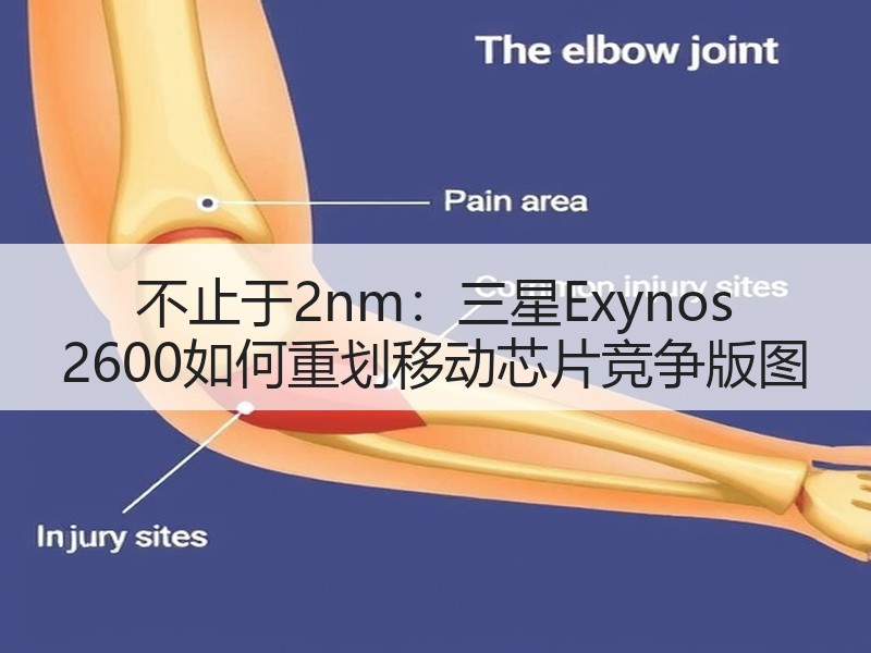 不止于2nm：三星Exynos 2600如何重划移动芯片竞争版图