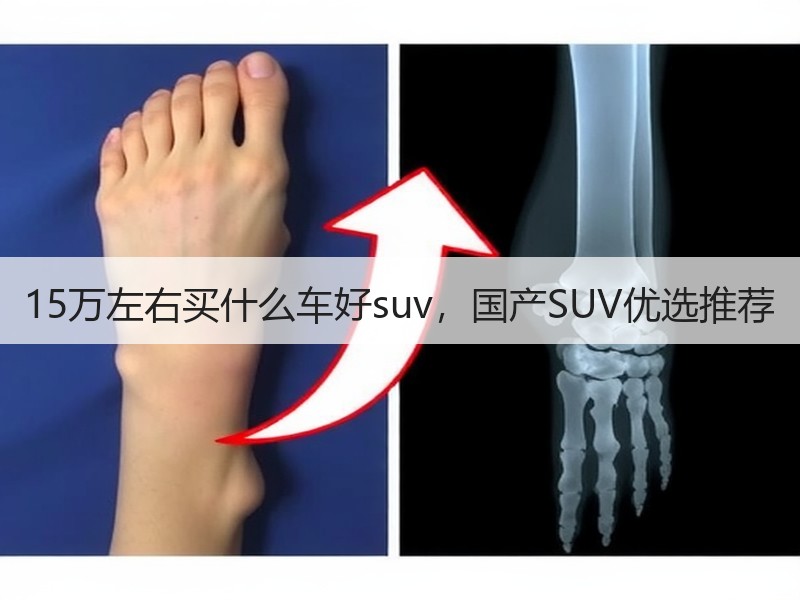 15万左右买什么车好suv，国产SUV优选推荐